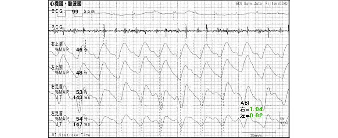 治療後のABI